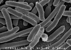 Escherichia coli, a Gram-negative bacterium widely studied in the lab as a model organism and also found in cases of food poisoning 