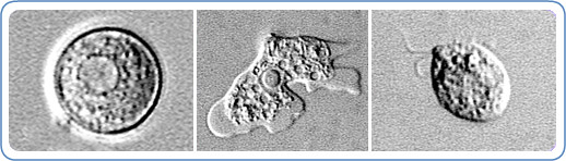 home_page_image_naegleria-vjf5-a